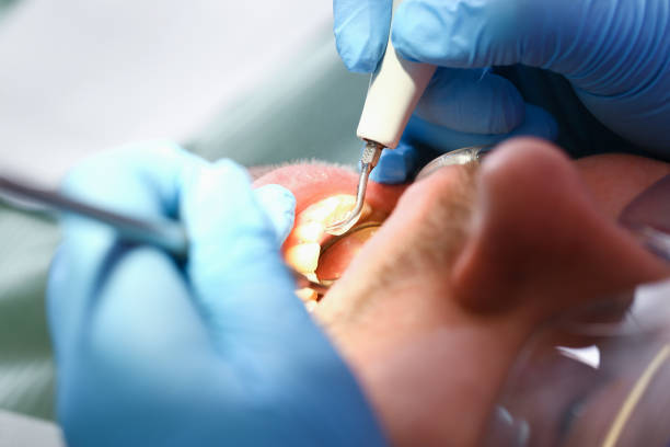 Best Chipped Tooth Repair Near Me  in Pleasureville, PA