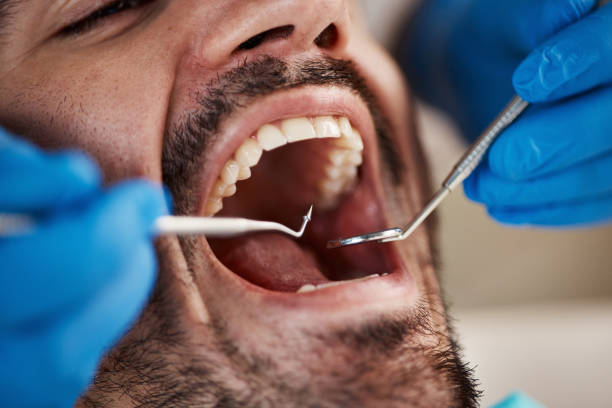 Best Dentist for Tooth Abscess  in Pleasureville, PA